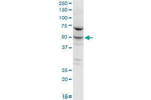 FARSLA polyclonal antibody (A01), Lot # 060102JC01. (Phenylalanyl-tRNA Synthetase, alpha Subunit (FARSA) (AA 101-201) antibody)