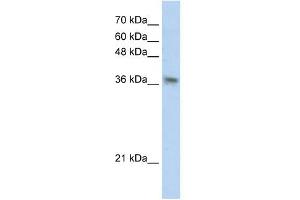 PHYHIP antibody used at 1 ug/ml to detect target protein.