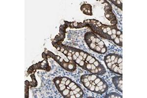 Immunohistochemical staining (Formalin-fixed paraffin-embedded sections) of human colon with FLNB polyclonal antibody  shows strong cytoplasmic and membranous positivity in glandular cells at 1:50-1:200 dilution. (FLNB antibody)