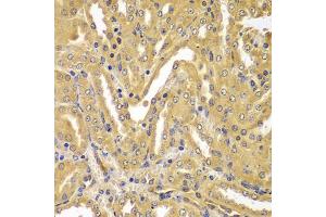 Immunohistochemistry of paraffin-embedded mouse kidney using UBE2Z antibody (ABIN5974351) at dilution of 1/100 (40x lens).