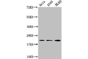 Western Blot Positive WB detected in: Hela whole cell lysate, A549 whole cell lysate, HL60 whole cell lysate All lanes: HIST1H1C antibody at 1:500 Secondary Goat polyclonal to rabbit IgG at 1/40000 dilution Predicted band size: 22 kDa Observed band size: 22 kDa (HIST1H1C antibody)