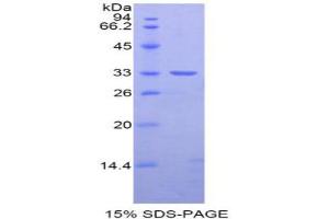 SDS-PAGE analysis of Rat Nexilin Protein. (NEXN Protein)