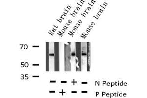 Western blot analysis of Phospho-COT (Thr290) expression in various lysates