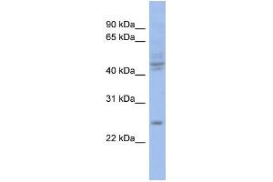 WB Suggested Anti-PROP1 Antibody Titration:  0. (PROP1 antibody  (Middle Region))