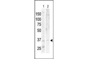 The anti-PKA/C alpha/beta Pab is used in Western blot to detect PKA/C alpha in Jurkat cell lysate (lane 1) and mouse heart tissue lysate (lane 2).