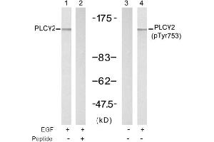 Image no. 1 for anti-Phospholipase C gamma 2 (PLCG2) (Tyr753) antibody (ABIN197402) (Phospholipase C gamma 2 antibody  (Tyr753))
