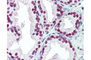Anti-NKX3-1 antibody IHC of human prostate.