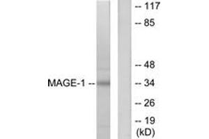 Western blot analysis of extracts from HepG2 cells, using MAGE-1 Antibody. (MAGEA1 antibody  (AA 260-309))
