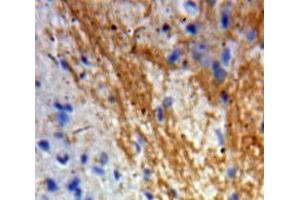 IHC-P analysis of Brain tissue, with DAB staining. (GDNF antibody  (AA 78-211))