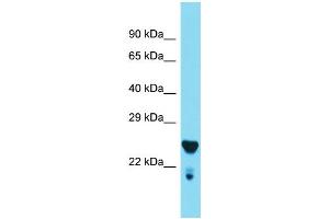 Western Blotting (WB) image for anti-Mediator Complex Subunit 29 (MED29) (Middle Region) antibody (ABIN2789154) (MED29 antibody  (Middle Region))
