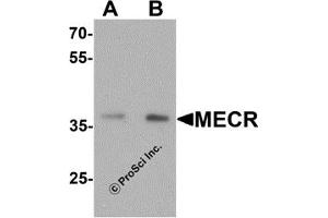 Western Blotting (WB) image for anti-Mitochondrial Trans-2-Enoyl-CoA Reductase (MECR) (C-Term) antibody (ABIN1077414) (MECR antibody  (C-Term))