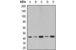 Western blot analysis of SerpinB1 expression in MCF7 (A), A549 (B), mouse lung (C), mouse spleen (D), rat spleen (E) whole cell lysates. (SERPINB1 antibody)