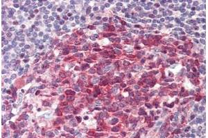 Human Tonsil: Formalin-Fixed, Paraffin-Embedded (FFPE) (GTF2A1 antibody  (AA 281-330))