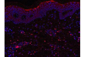 Labelling on paraffin section from psoriasis lesions with B-Z23 diluted at 1:500 (background colouration by DAPI) (IL23 antibody)