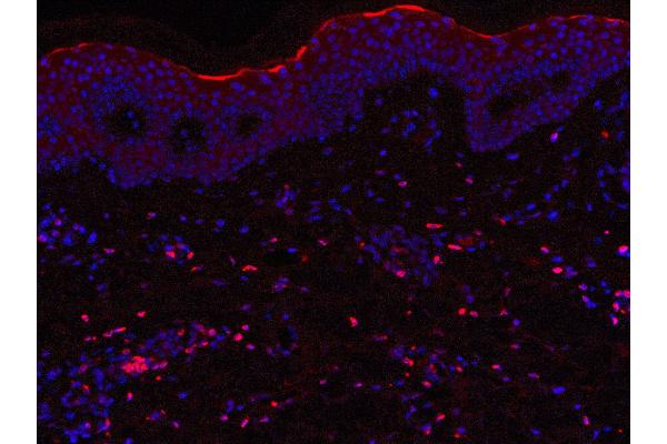 IL23 antibody