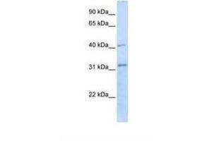 Image no. 1 for anti-STIP1 Homology and U-Box Containing Protein 1 (STUB1) (AA 218-267) antibody (ABIN6738054) (STUB1 antibody  (AA 218-267))