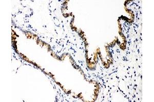 IHC-P: GSTP1 antibody testing of rat lung tissue (GSTP1 antibody  (AA 2-210))