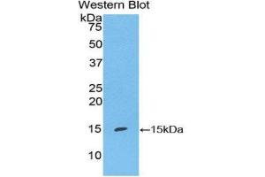 Western Blotting (WB) image for anti-S100 Calcium Binding Protein A7 (S100A7) (AA 1-108) antibody (ABIN1860486) (S100A7 antibody  (AA 1-108))