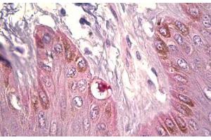 Anti-DCT antibody IHC staining of human skin, melanocytes. (DCT antibody  (AA 51-100))