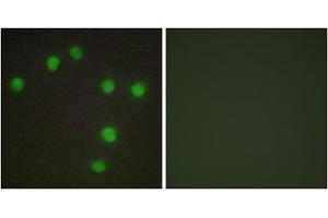 Immunofluorescence analysis of HUVEC cells, using NKX6. (NK6 Homeobox 3 antibody  (Internal Region))