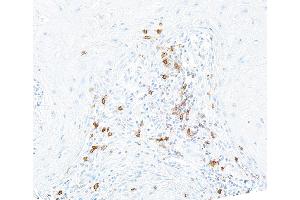 Immunohistochemistry (IHC) image for anti-Inducible T-Cell Co-Stimulator (ICOS) (AA 149-199) antibody (ABIN7453973) (Recombinant ICOS antibody  (AA 149-199))