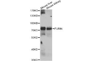 Western blot analysis of extracts of various cell lines, using FURIN antibody (ABIN4903706) at 1:1000 dilution. (FURIN antibody)