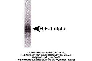 Image no. 1 for anti-Hypoxia Inducible Factor 1, alpha Subunit (Basic Helix-Loop-Helix Transcription Factor) (HIF1A) (AA 329-530) antibody (ABIN363215) (HIF1A antibody  (AA 329-530))