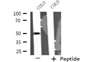 Western blot analysis of extracts from COLO cells, using STK24 antibody. (STK24 antibody  (N-Term))