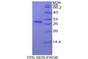 SDS-PAGE analysis of Human Pyridoxal Kinase Protein.