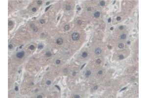 Detection of AZIN1 in Human Liver Tissue using Polyclonal Antibody to Antizyme Inhibitor 1 (AZIN1) (Antizyme Inhibitor 1 antibody  (AA 5-290))