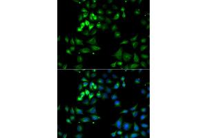 Immunofluorescence analysis of A549 cell using HYOU1 antibody. (HYOU1 antibody)