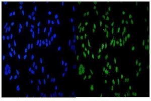IF analysis of HDAC9 using anti-HDAC9 antibody (ABIN7602333). (HDAC9 antibody  (AA 7-469))