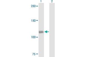 Western Blot analysis of CSF2RB expression in transfected 293T cell line by CSF2RB MaxPab polyclonal antibody. (CD131 antibody  (AA 1-889))