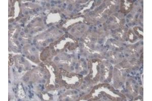 Immunohistochemistry (IHC) image for anti-Core-Binding Factor, beta Subunit (CBFB) (AA 1-187) antibody (ABIN7444325)