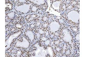 IHC analysis of C1orf77/FOP/CHTOP using anti-C1orf77/FOP/CHTOP antibody (ABIN7603201).