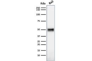 Western Blot Analysis of Raji cell lysate using CD79a Mouse Monoclonal Antibody (HM47/A9). (CD79a antibody  (AA 202-216))