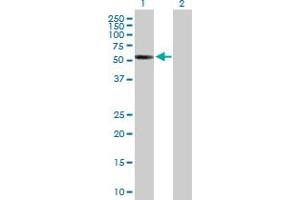 Western Blot analysis of CDYL2 expression in transfected 293T cell line by CDYL2 MaxPab polyclonal antibody. (CDYL2 antibody  (AA 1-506))