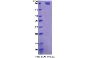 SDS-PAGE (SDS) image for Transcription Factor Dp-1 (TFDP1) (AA 6-410) protein (His tag,GST tag) (ABIN6238631) (DP1 Protein (AA 6-410) (His tag,GST tag))