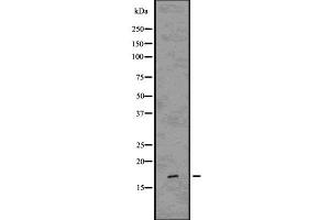 Western blot analysis of Caveolin 3 using HepG2 whole cell lysates (Caveolin 3 antibody  (N-Term))