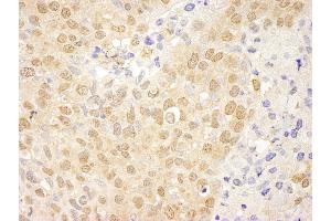 Immunohistochemistry (IHC) image for anti-C-Abl Oncogene 1, Non-Receptor tyrosine Kinase (ABL1) (AA 850-900) antibody (ABIN7448914) (ABL1 antibody  (AA 850-900))