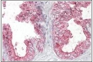 Image no. 1 for anti-Kallikrein 2 (KLK2) (Internal Region) antibody (ABIN374827) (Kallikrein 2 antibody  (Internal Region))