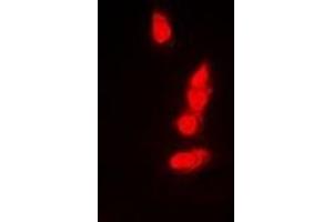 Immunofluorescent analysis of PSMB8 staining in A549 cells. (PSMB8 antibody)