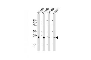 Lane 1: mouse brain lysates, Lane 2: rat brain lysates, Lane 3: SW480 Cell lysates, Lane 4: human brain lysates, probed with RAB3B (1543CT354. (RAB3B antibody)