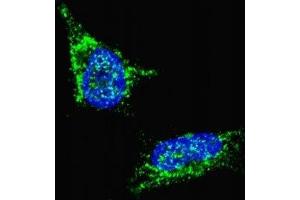 Fluorescent confocal image of SY5Y cells stained with LIN28B antibody. (LIN28B antibody  (AA 1-30))