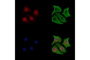 ABIN7093512 and ABIN7097536 staining Hela cells by IF/ICC.