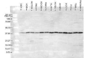 Western blot analysis of Human cancer cell lines showing detection of p38 protein using Rabbit Anti-p38 Polyclonal Antibody . (MAPK14 antibody  (Atto 488))