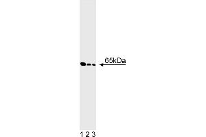 Western Blotting (WB) image for anti-Glutamate Decarboxylase 2 (Pancreatic Islets and Brain, 65kDa) (GAD2) antibody (ABIN967657) (GAD65 antibody)