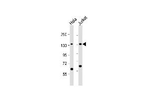 All lanes : Anti-SF3B3 Antibody (C-term) at 1:1000 dilution Lane 1: Hela whole cell lysate Lane 2: Jurkat whole cell lysate Lysates/proteins at 20 μg per lane. (SF3B3 antibody  (C-Term))