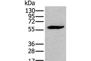 Western blot analysis of LNCAP cell lysate using EGR2 Polyclonal Antibody at dilution of 1:300 (EGR2 antibody)