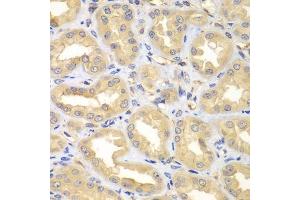 Immunohistochemistry of paraffin-embedded human kidney using ELMO3 antibody. (ELMO3 antibody  (AA 504-773))
